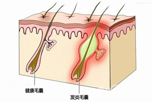 几张图，带你认识我们的头皮