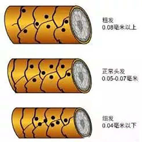 头发变细变软，及时预防摆脱脱发风险
