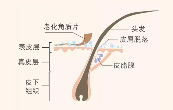 头发油的快还越洗越油，到底应该怎么办