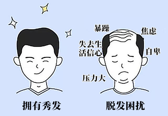 脱发，比你想象的更可怕